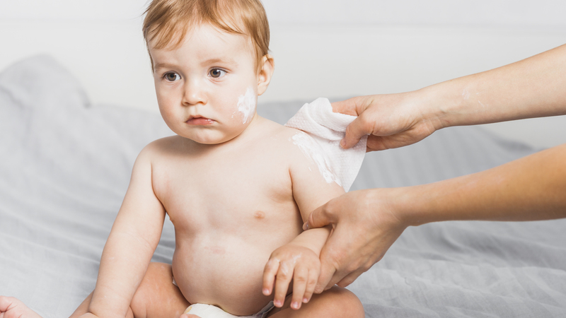 Blister:go9we_jntfg= Diaper Rash: Causes, Prevention, and Treatment